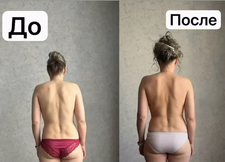 Ира: спина до и после
